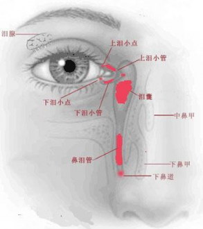 泪道疾病有哪些有效治疗方案